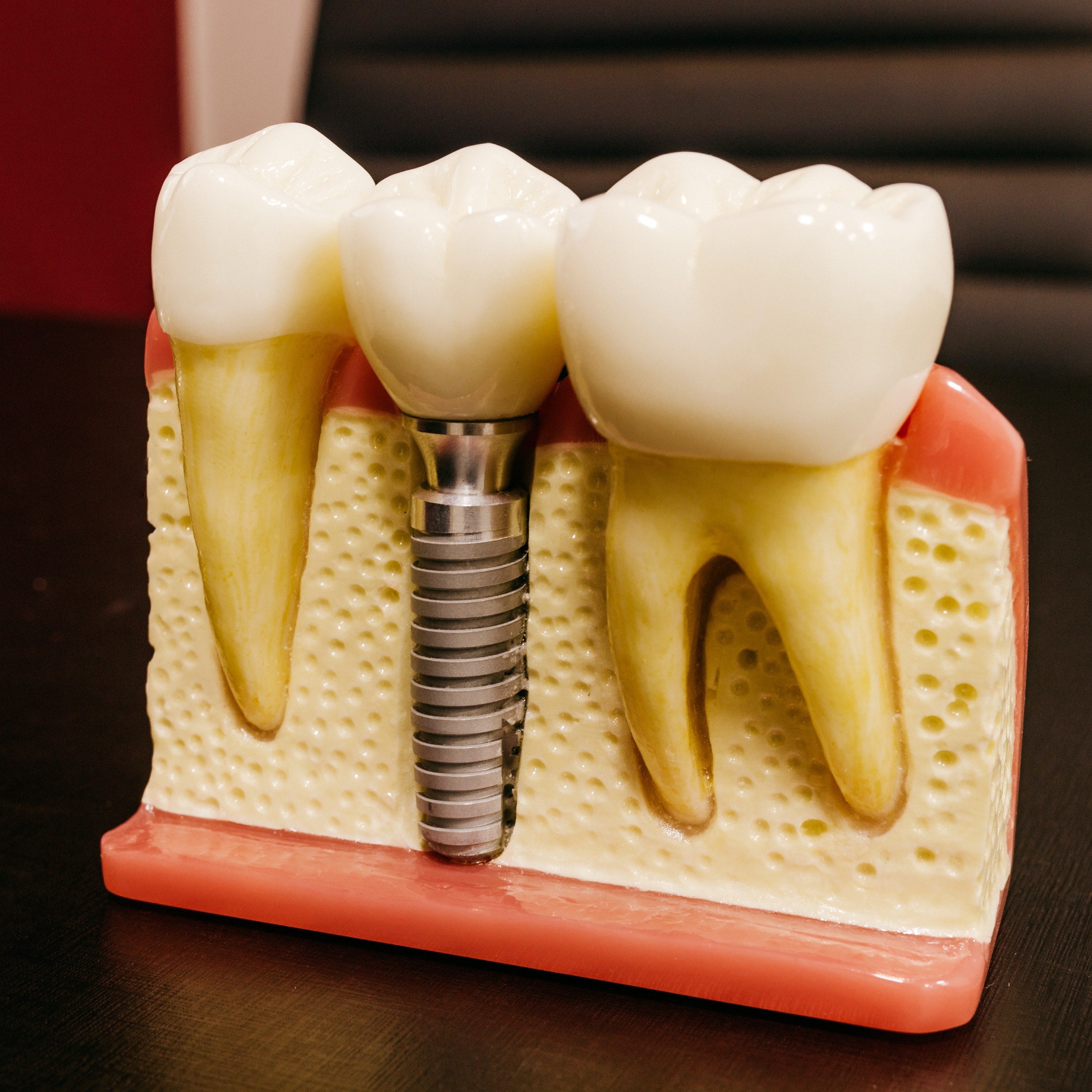 Zima Dental Review 93 - 2ovp82a